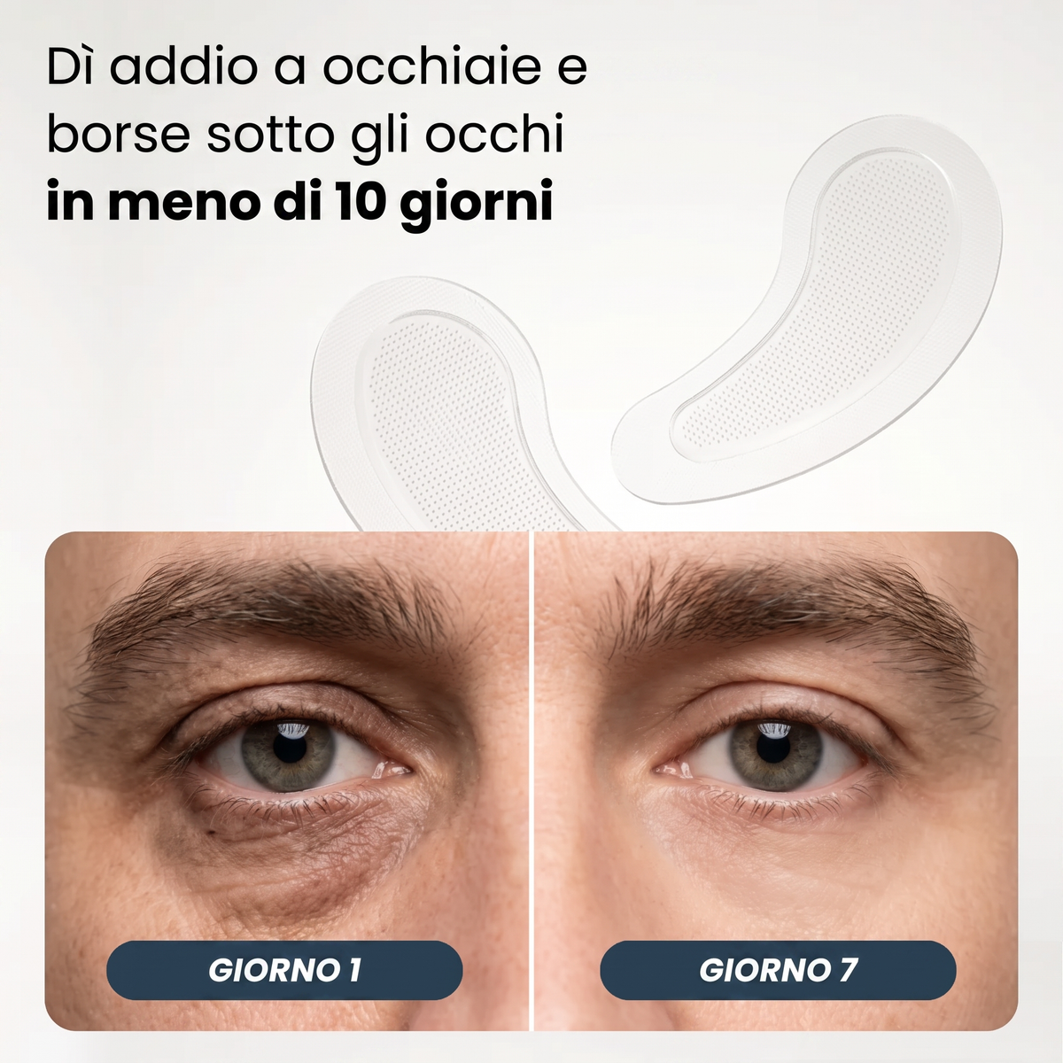 Patch Micro-Aghi | Nuova Generazione